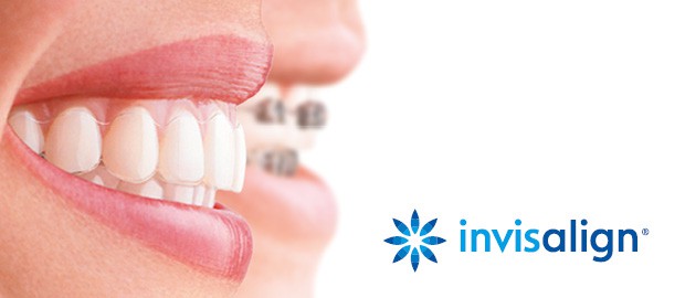 Инвизилайн i7 - имплантация зубов в индии
